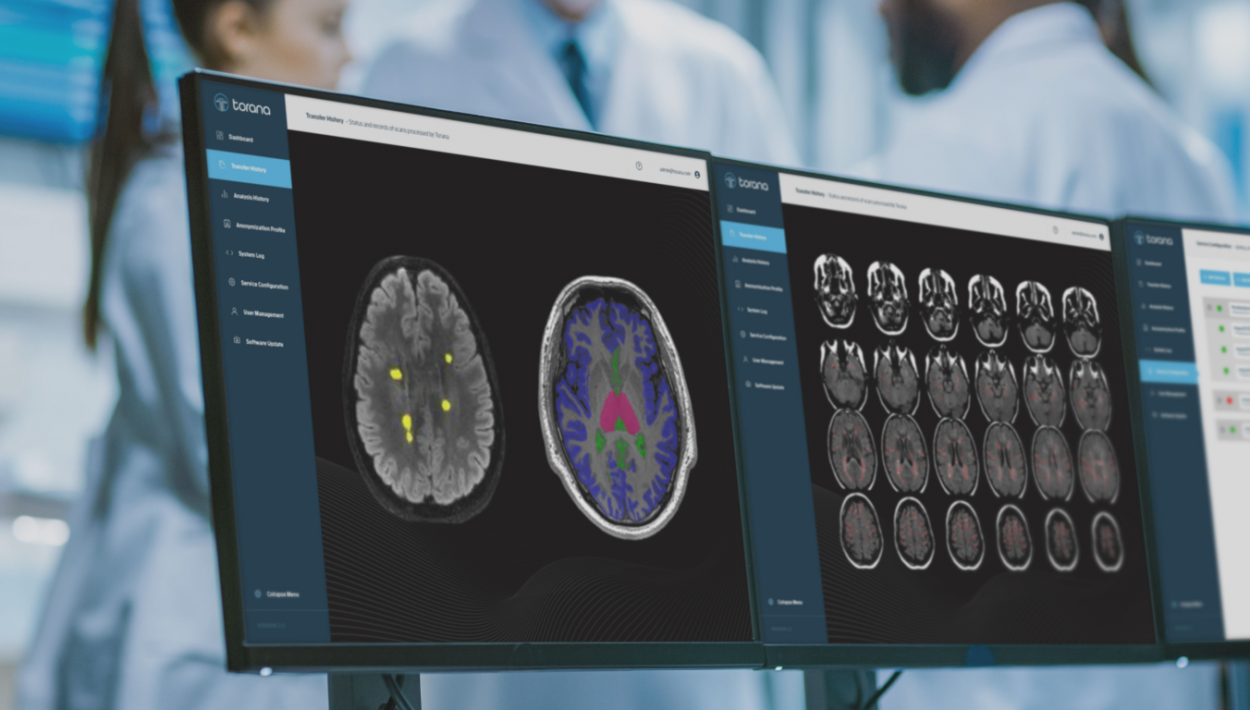 A neuroimaging research facility located in Sydneys Brain and Mind Centre